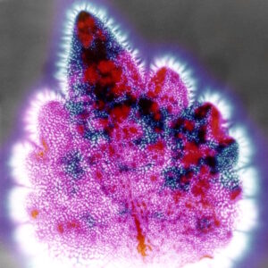 kirlian_photograph_of_a_coleus_leaf_1980. Image by Wilipedia